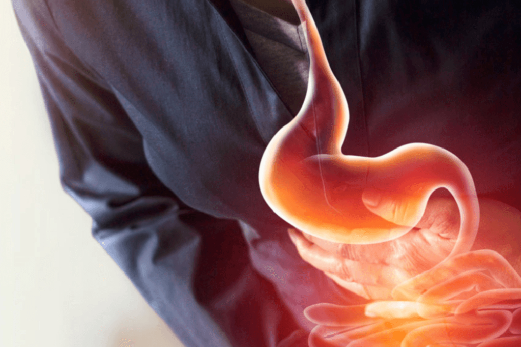 gerd-diet-to-be-followed-while-suffering-from-acid-reflux-constantly-2