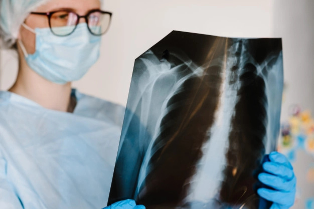 All you need to know about COPD