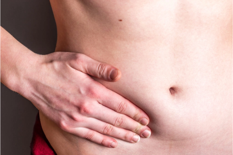 All you need to know about Hernia.