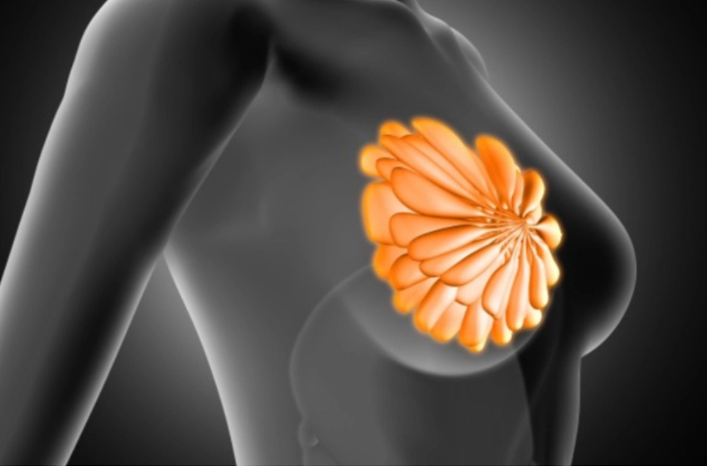 Breast-Cancer-Causes-Diagnosis-Treatments