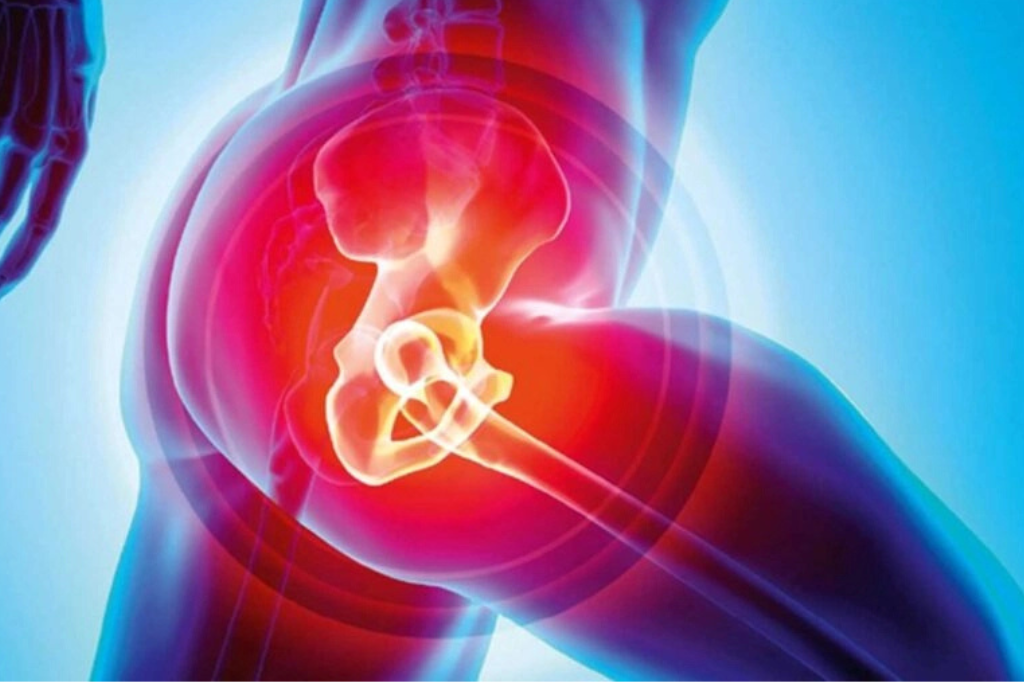 Do you require Hip Replacement.