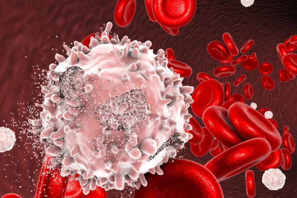 Know-more-about-Blood-cancer