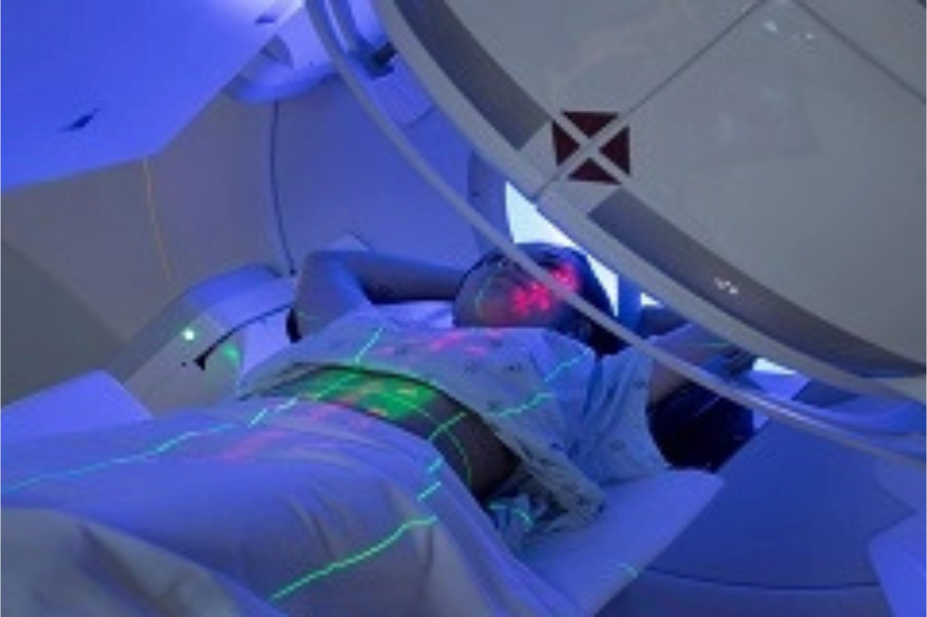 Know-more-about-Radiation-Therapy