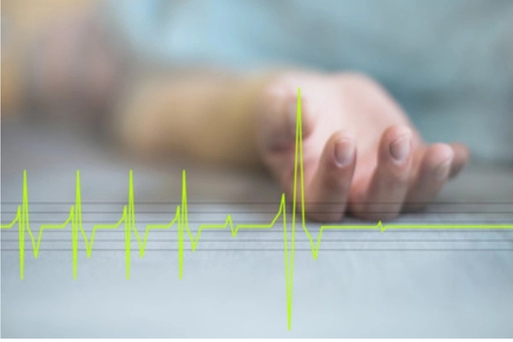 What is the difference between heart attack and cardiac arrest
