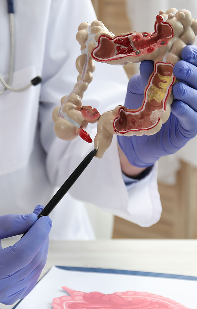Why Choose Ujala Cygnus Hospitals for Colonoscopy