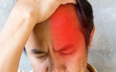 cluster-headache