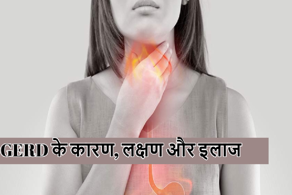 gerd-symptoms-and-acid-reflux-treatment-with-gerd-causes