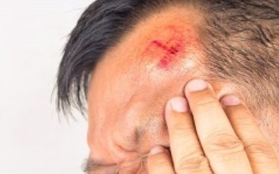 head-injury