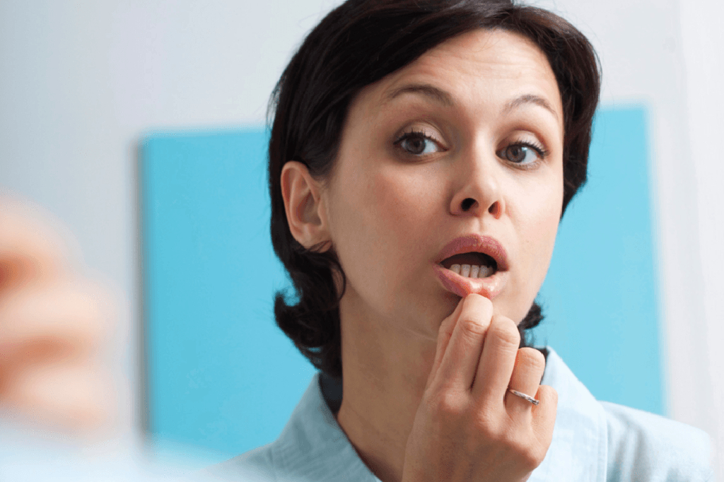 How To Cure Mouth Ulcers Fast And Naturally?