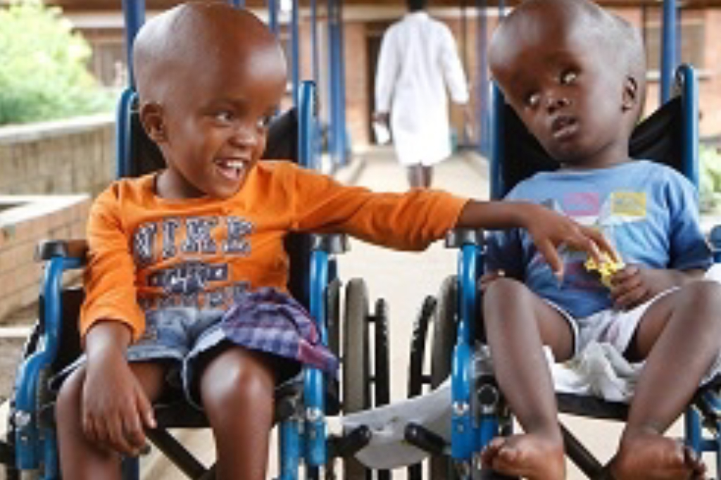 hydrocephalus