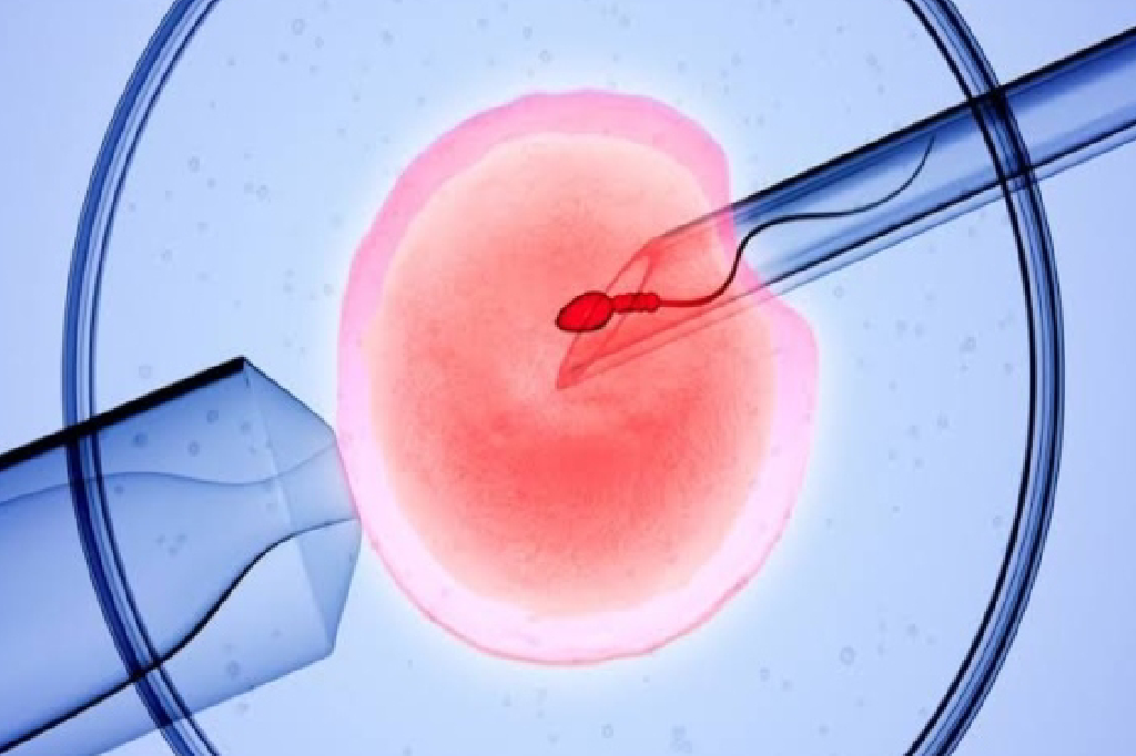 ivf-pregnancy-symptoms