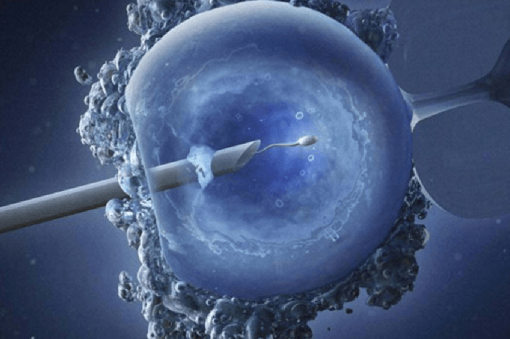 IVF तकनीक द्वारा अपने ही एग और स्पर्म से बन सकते हैं पेरेंट्स