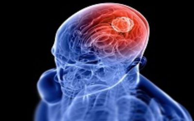 know-more-brain-tumor