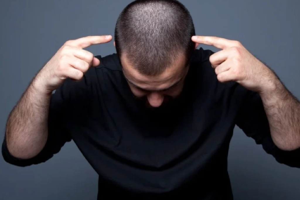 How To Reduce Side Effects Of Finasteride?