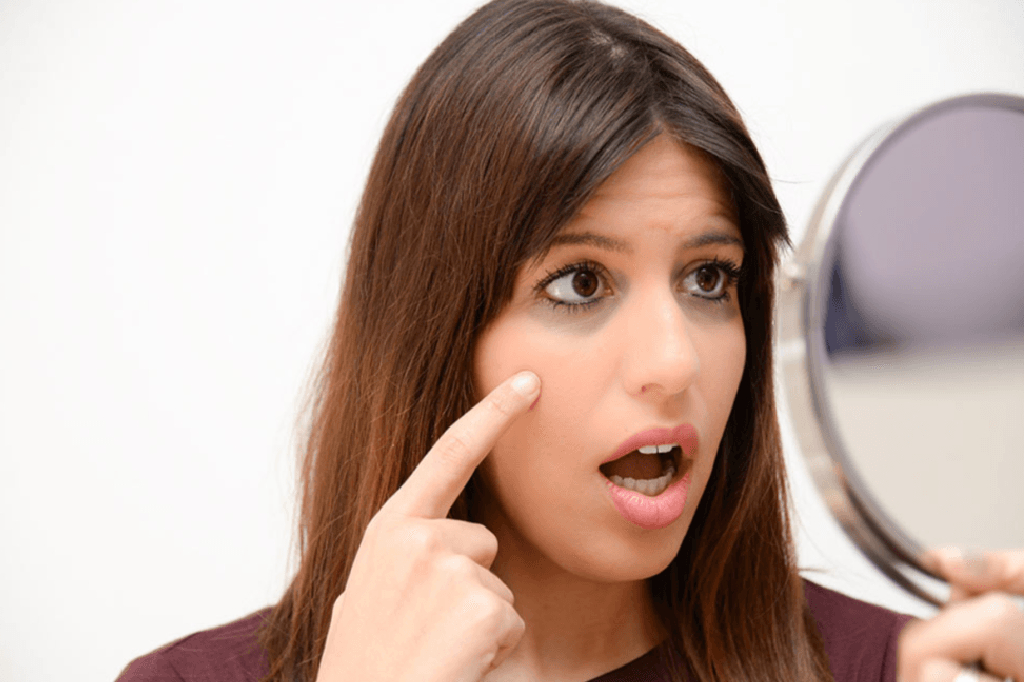Which Kind Of Deficiencies Cause Dark Circles?