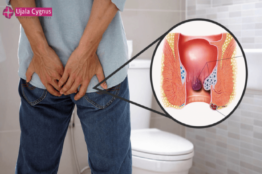 symptoms-for-piles-in-male-and-female-2