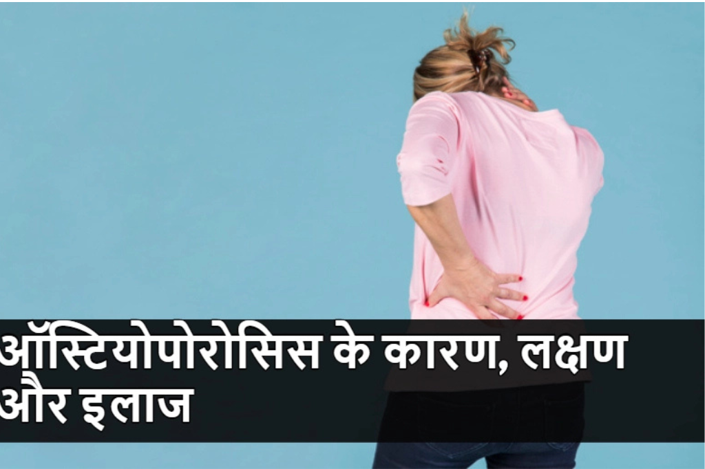 जानिए-क्या-हैं-ऑस्टियोपोरोसिस-के-कारण-लक्षण-और-इलाज.