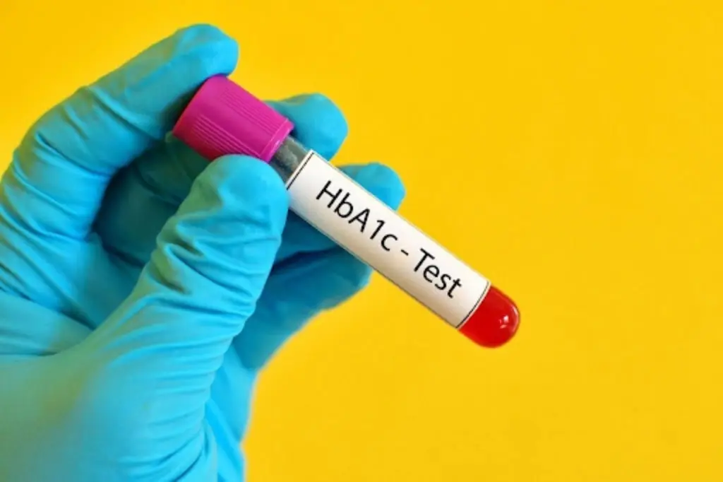 HbA1c-Test-Explained-Normal-Ranges-Diabetes-Levels-and-How-to-Read-Your-Results